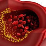 Kanın Potasyum Değeri Nasıl Düşürülür