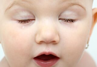 Bebeklerde Göz İltihabı ve Çapaklanması